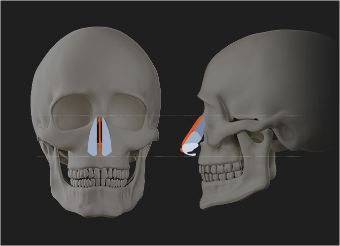 nose implants slider 01 pc