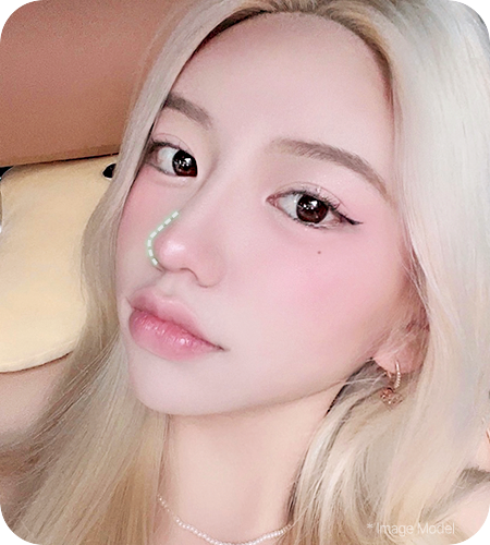 nose not implants method right 1 pc new