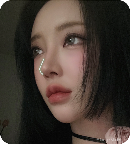 nose not implants method right 2 pc