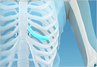 nose not implants type 3 pc