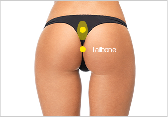 nose not implants type 4 pc