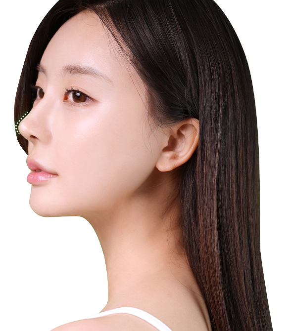 nose not implants visual pc