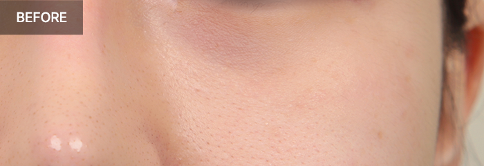 province realselfi 1 mo