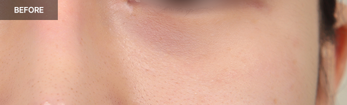 province realselfi 1 pc