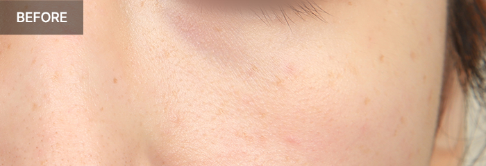 province realselfi 3 mo