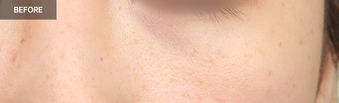 province realselfi 3 pc