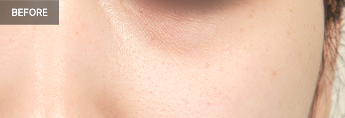 province realselfi 5 mo