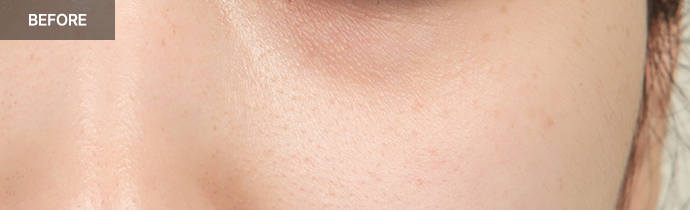 province realselfi 5 pc