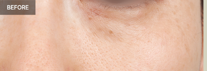 province realselfi 7 mo