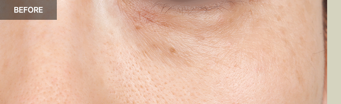 province realselfi 7 pc