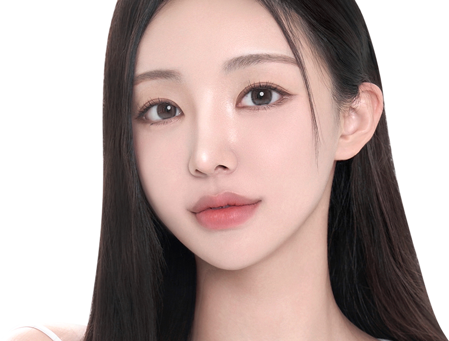 Under Eye Fat Reposition 16 province visual img pc