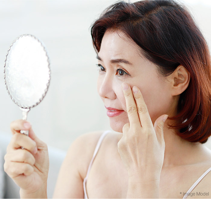 Blepharoplasty 34 upper lower slide 01 mo