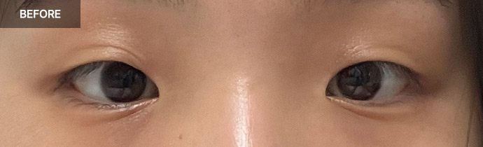 eyelid combo 01 before pc
