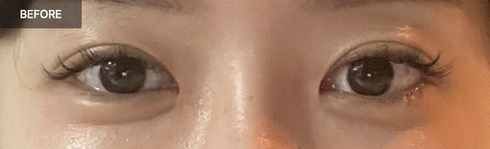 eyelid combo 02 before pc