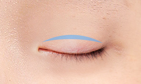 male eye method 04 01 pc