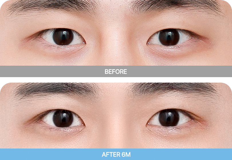 male eye two pc