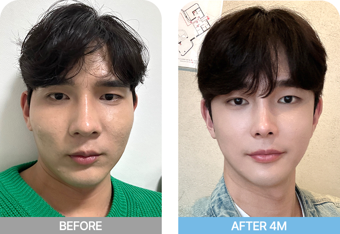 male face two mo