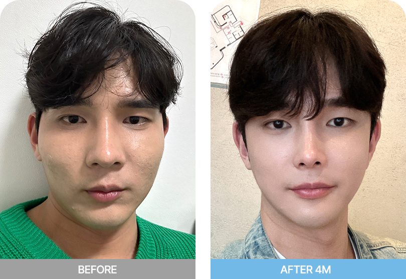 male face two pc