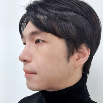 Male Surgery 76 male gif c 06 mo