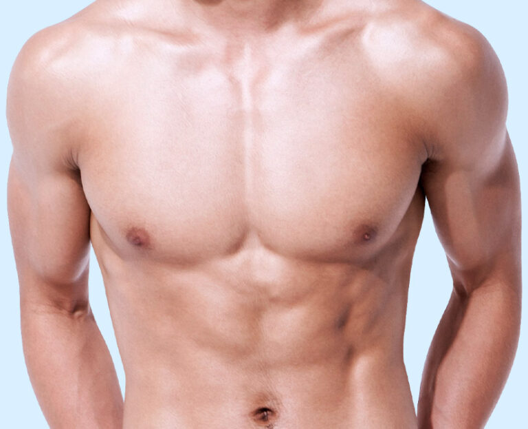 male gyne mian viz pc 768x623 1