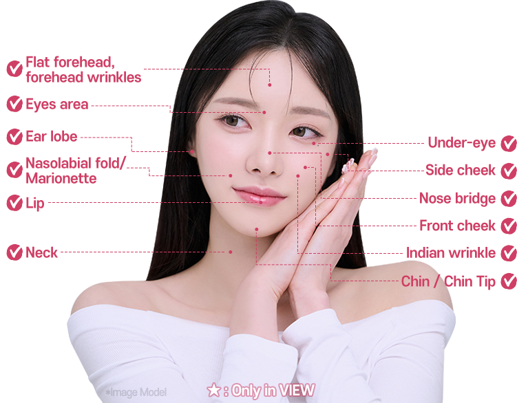 mo 02filler