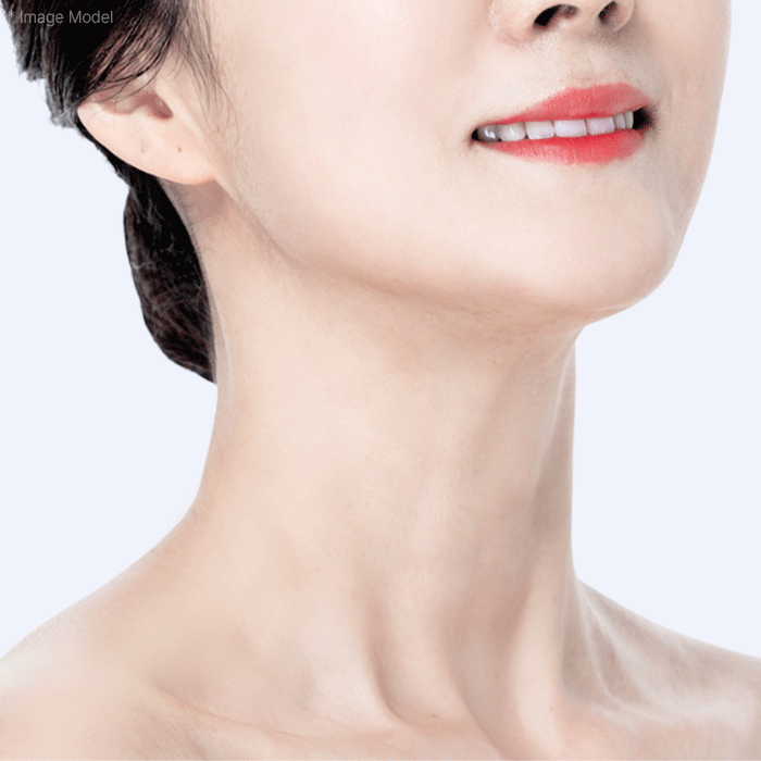 mo gif neck lifting