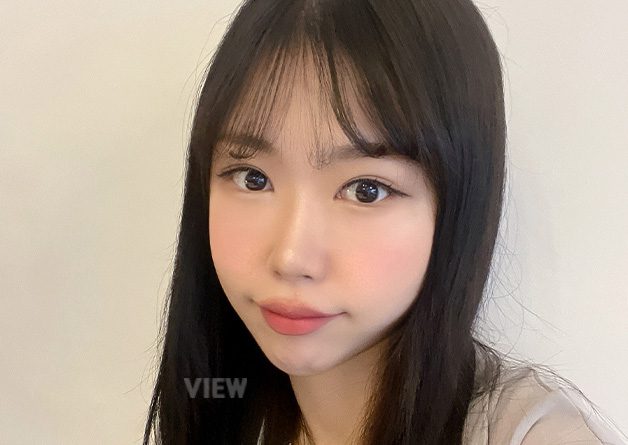 Review of Revision Double Eyelid Surgery at View Plastic Surgery Clinic in Korea