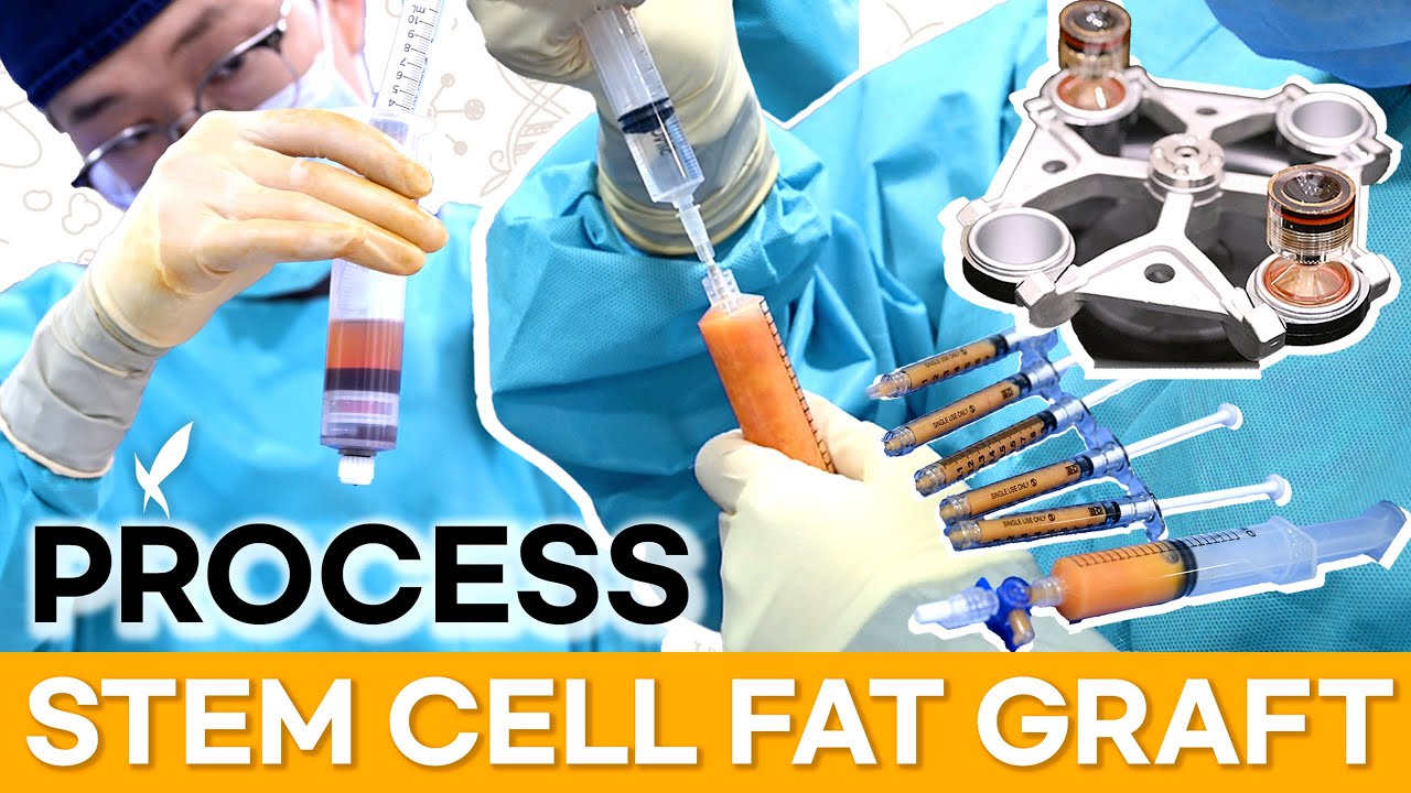 stem cell process thumb