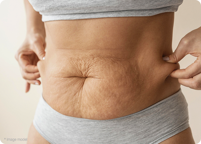 abdominoplasty recommendation target mo