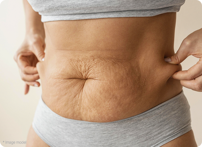 abdominoplasty recommendation target