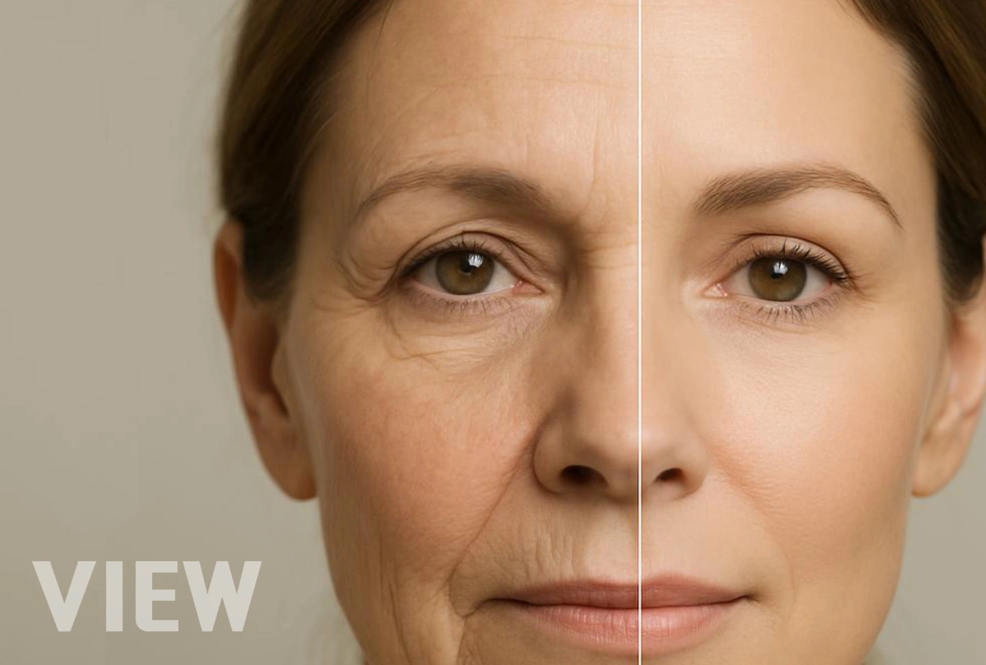 Comparative medical illustration of facelift surgery in Korea, explaining the differences between deep plane facelift and SMAS facelift approaches and how each technique affects facial structure.