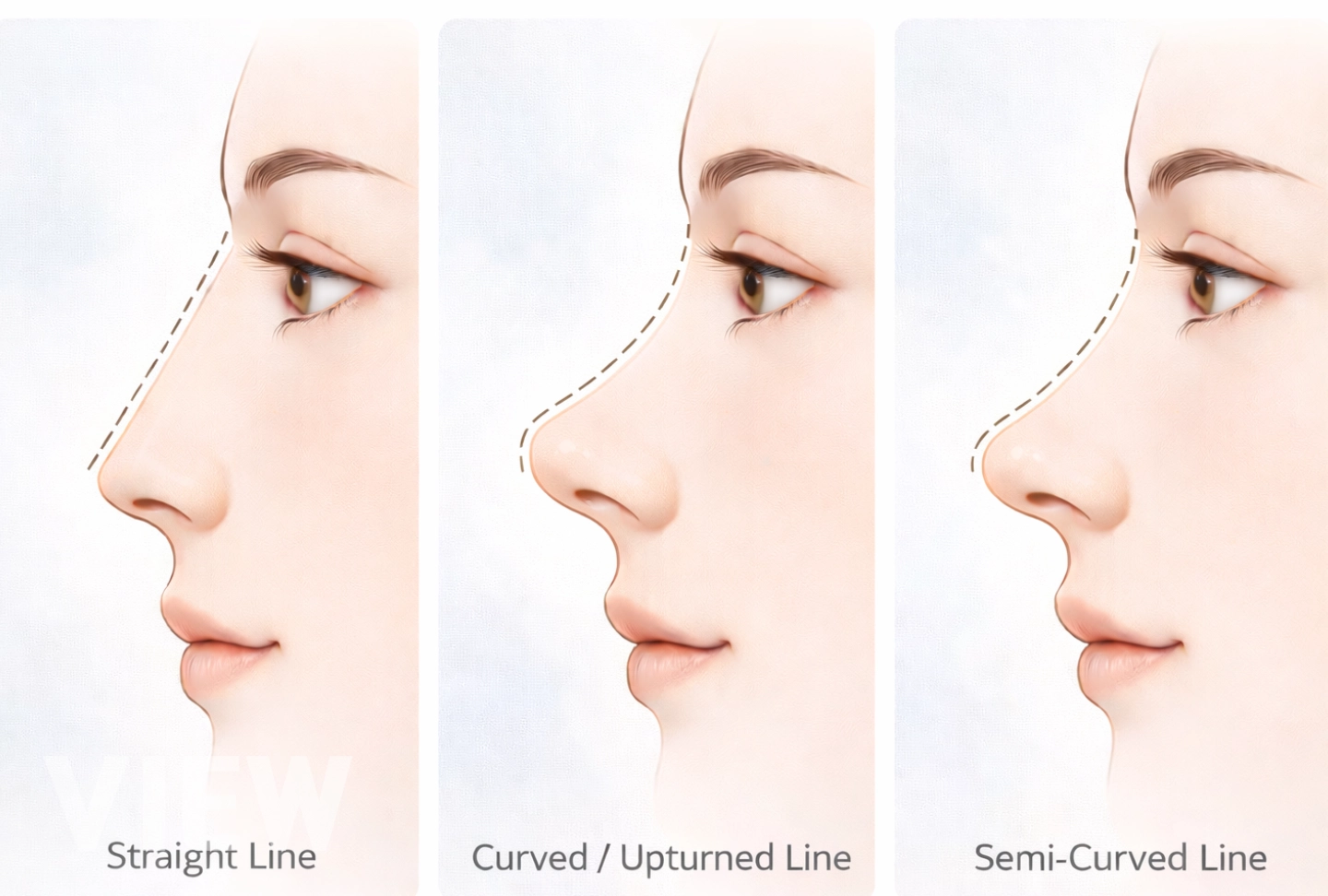 Guide image explaining how to identify the nose line that best suits your facial proportions, focusing on nasal bridge height, tip projection, and overall facial balance