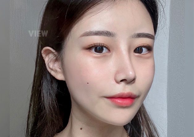 Rhinoplasty & Facial Contouring Surgery in Korea Real Review