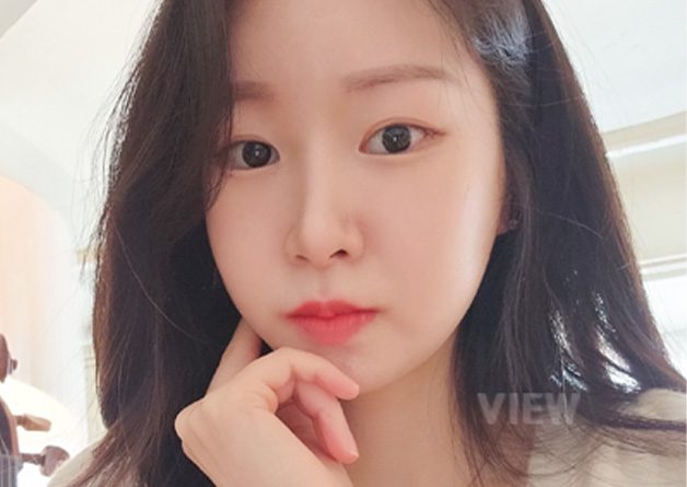 Review of Rhinoplasty, Face Contouring, and Fat Grafting at View Plastic Surgery in Korea