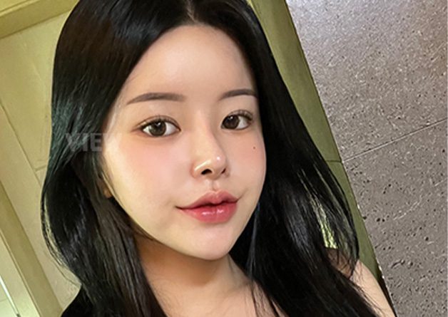 10-Month Honest Review at View Plastic Surgery in Korea