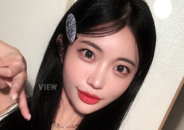 Non-incisional Double eyelid surgery Review at View Plastic Surgery