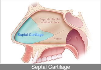 Anatomical diagram showing septal cartilage used in rhinoplasty as an autologous graft for nasal tip support and structural refinement