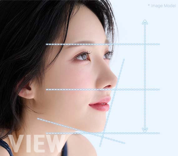 From Structural Realignment to Visible Results