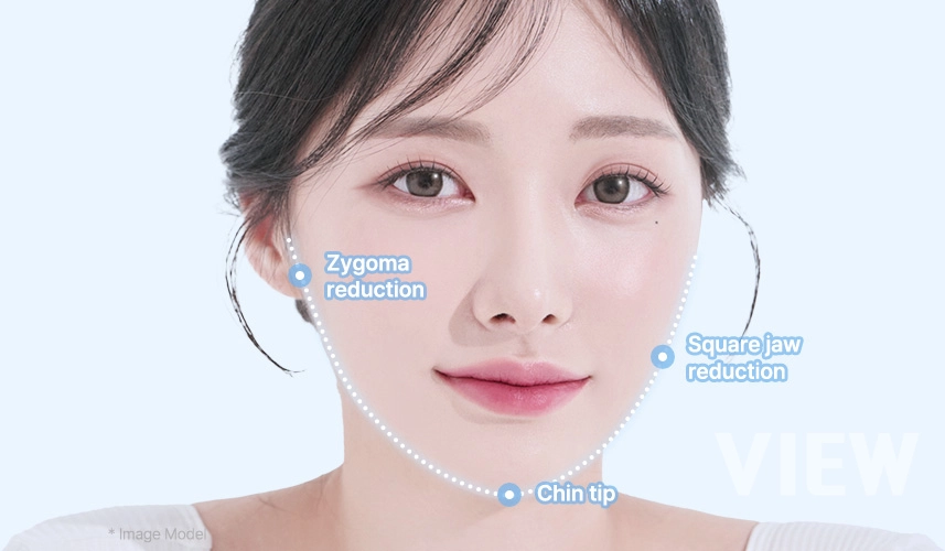 Illustrative image explaining selective adjustment of key facial bone structures in facial contouring surgery to achieve balanced and natural facial proportions
