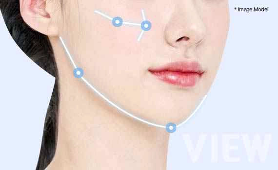 Diagram showing why the direction and position of bone movement are more important than the amount of bone reduction in facial contouring surgery