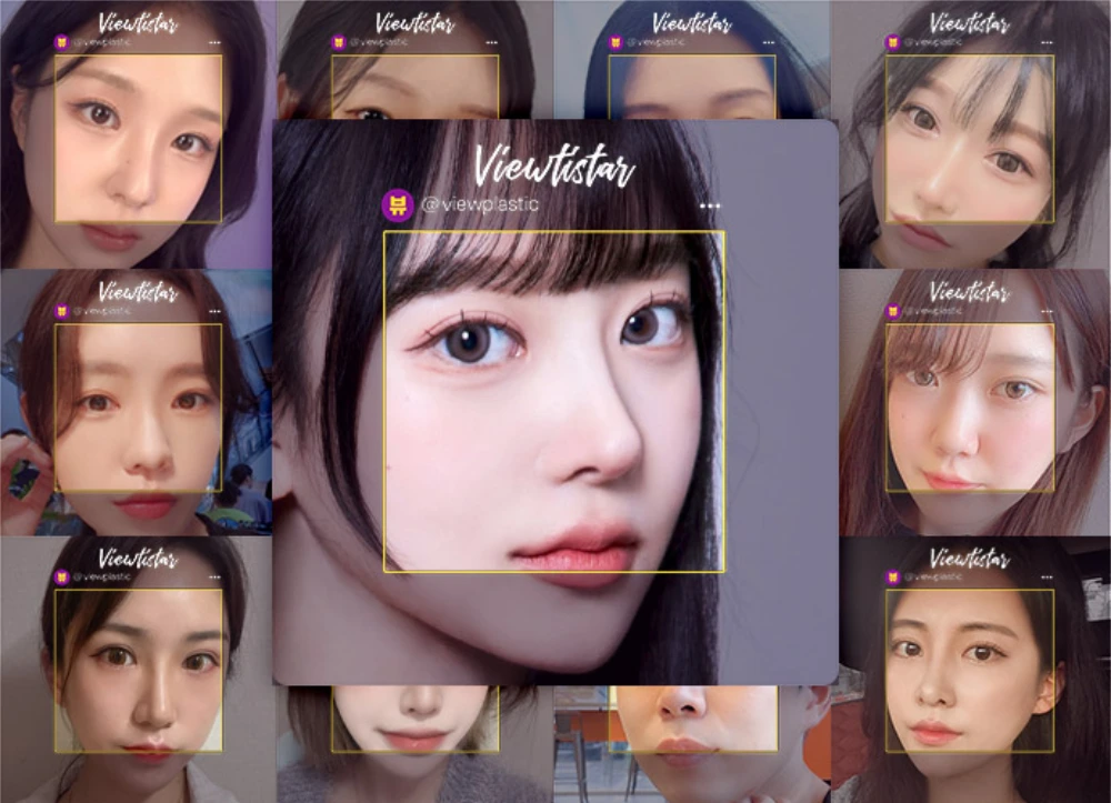 AI-based facial analysis and design comparison using influencer case images at View Plastic Surgery