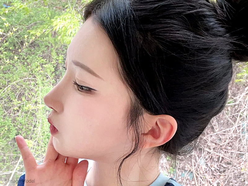 img deviatde sub01 mo