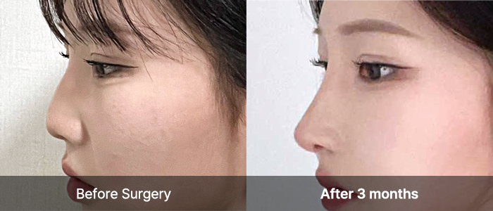 img deviatde sub02 mo