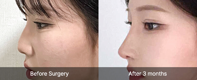 img deviatde sub02 pc