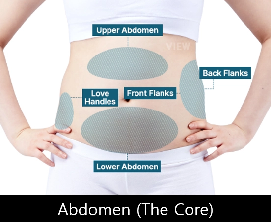 Abdomen liposuction target areas including upper abdomen, lower abdomen, love handles, and flanks in Korea