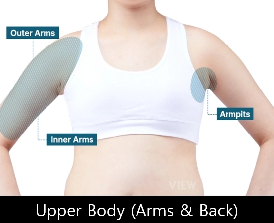 Abdomen liposuction target areas including upper abdomen, lower abdomen, love handles, and flanks in Korea