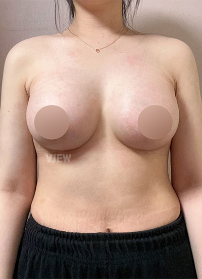 D21 5 보정온라인팀사용