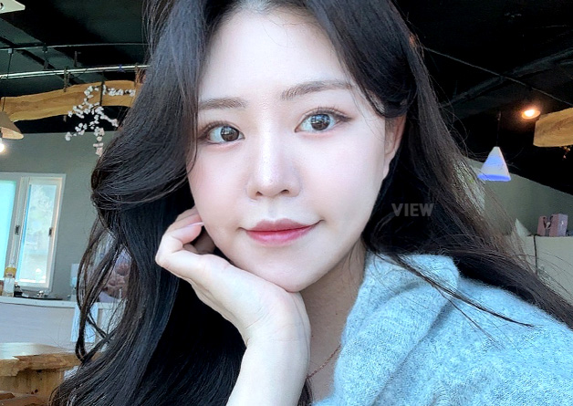 My Facial Contouring Surgery in Korea at VIEW Clinic Real Review