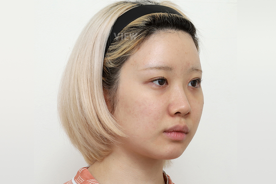 Before
