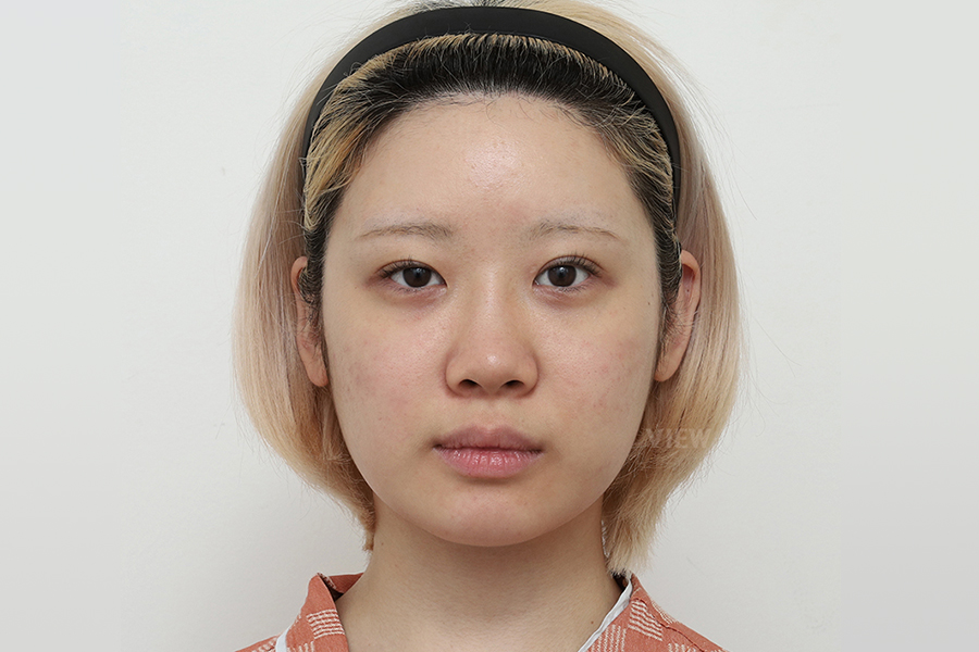 Before